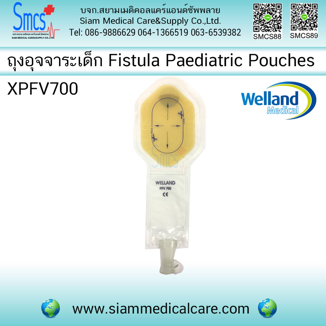 ถุงอุจจาระหน้าท้องเด็กพร้อมแป้น Fistula Paediatric Pouches ยี่ห้อ Welland (Lleostomy Pouches)