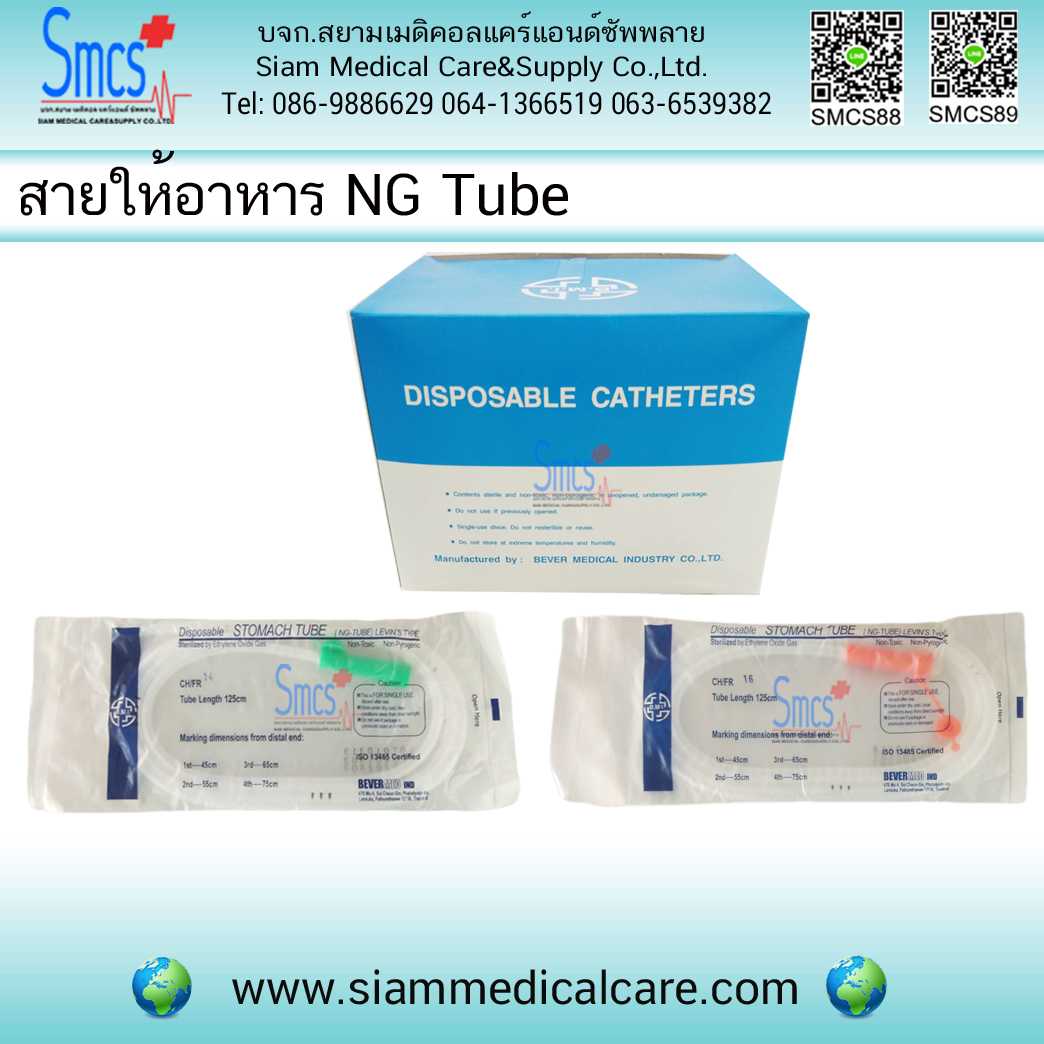 สายให้อาหารทางจมูก ( NG Tube )
