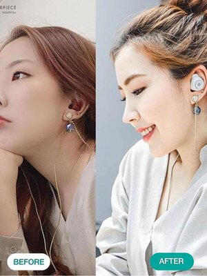 รับทำศัลยกรรมโดยทีมแพทย์ผู้เชี่ยวชาญ ปลอดภัย ได้มาตรฐาน พร้อมเปลี่ยนคุณให้สวยมั่นใจยิ่งขึ้น